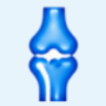 Total Knee Replacement