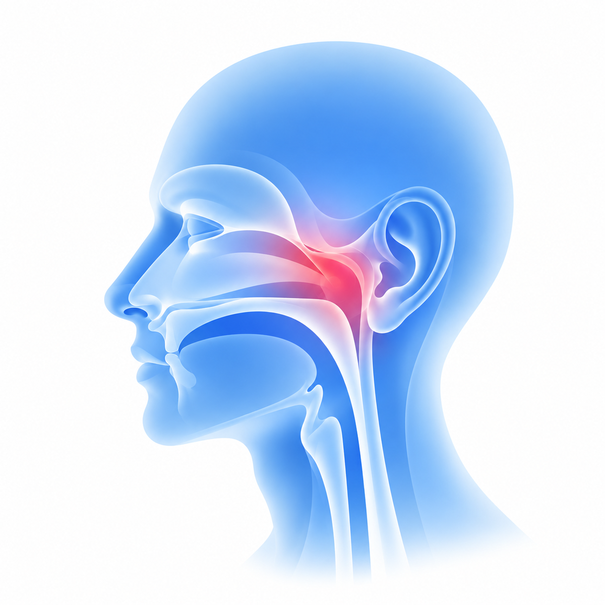 Nasopharyngeal Cancer