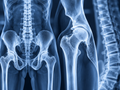 Orthopedics & Spine